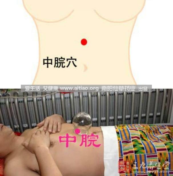 中脘穴位于腹部正中線，臍上4寸的位置上。每天艾灸10-15分鐘，能有效緩解胃部不適的癥狀，同時有助于祛濕。